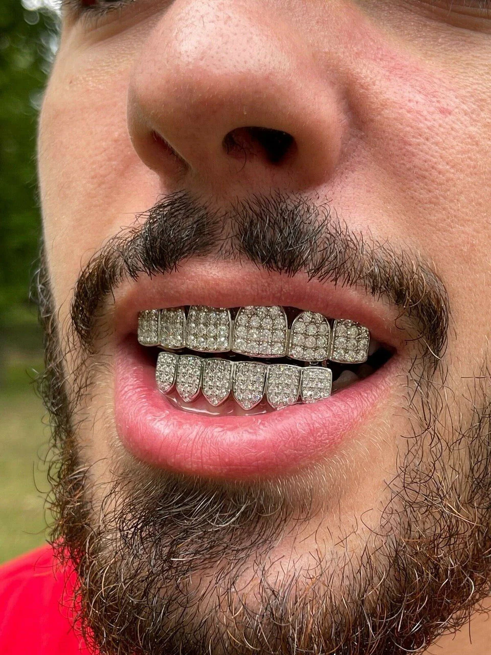 Thumbnail 13